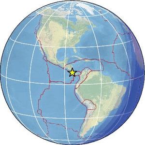 Global view