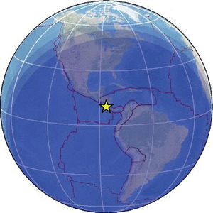 Global view