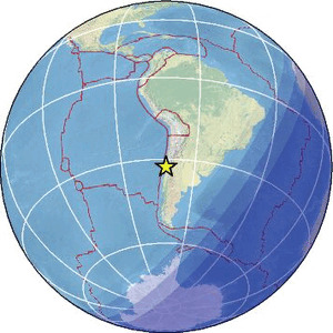 Global view